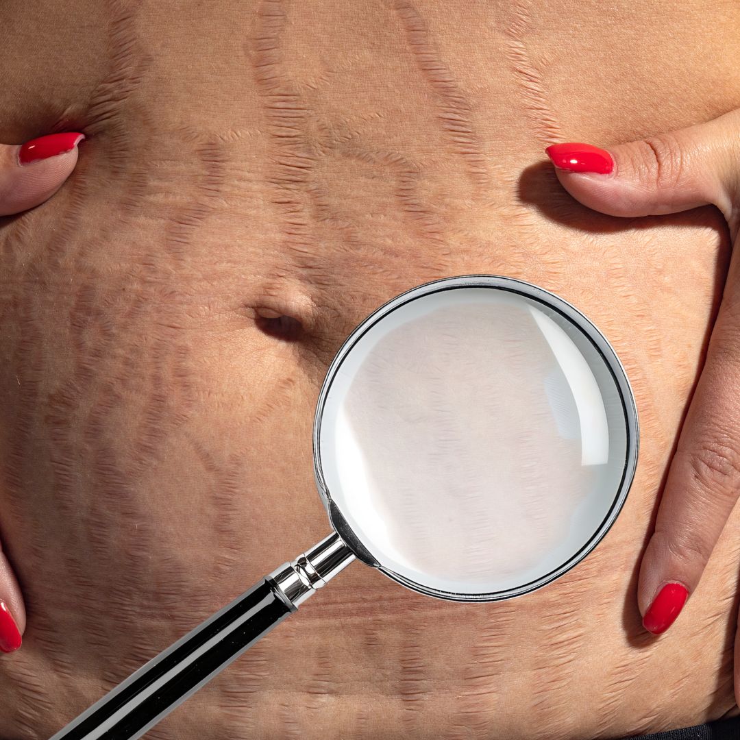 Consultation de Peau - Corps image